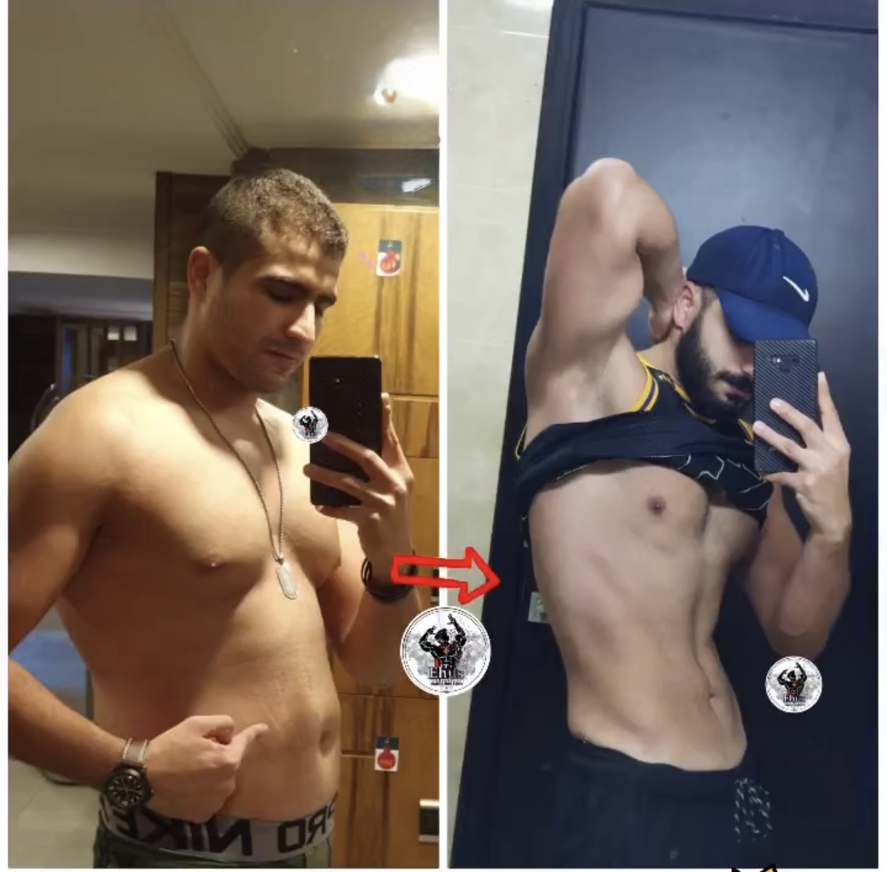 Dr. Hazem Elsout transformation